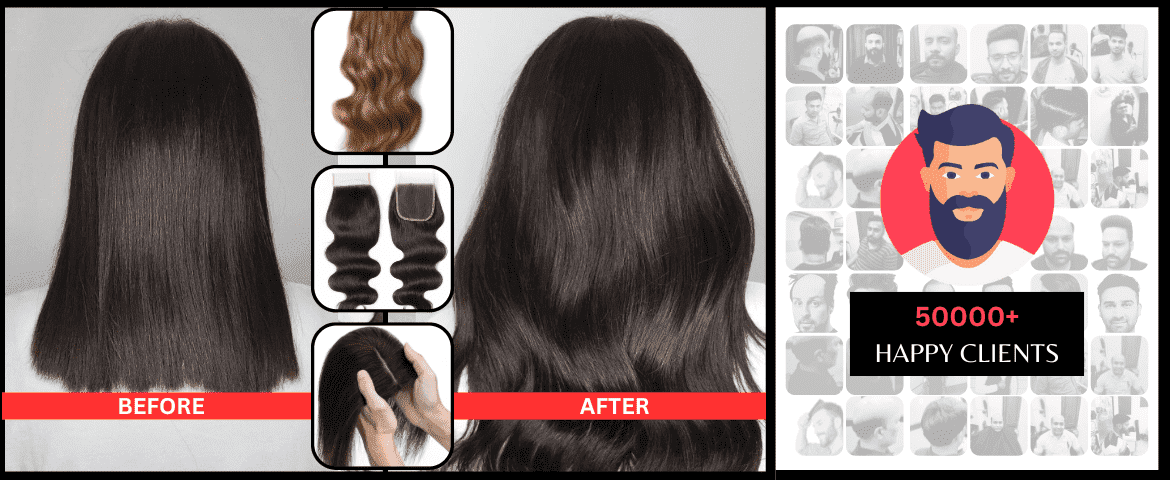 women hair toppers, hair Closure for women