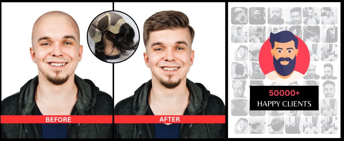 Chemo hair wigs and patch, Chemo wigs for women