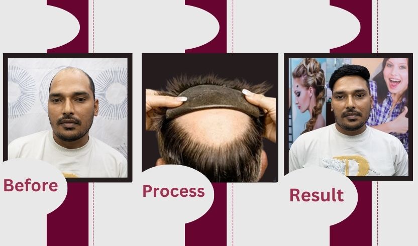 Best hair bonding service,Bonding service near me,Hair bonding service for men,Hair bonding service for women,Hair bonding service price