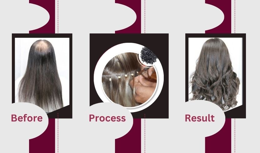 Hair Microwefting Service in delhi, Hair microwefting service near me, Hair Microwefting Service for women, Best Microwefting Service in Delhi NCR
