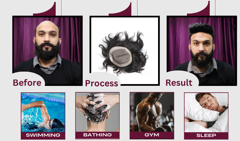 Men’s Thick Patch, Polyfuse Patch for Men, Thick Hair Patch for Men, Men’s Polyfuse Hair Patch, Natural-Look Hair Patch, Durable Hair Patch for Men, Men’s Hair Replacement Patch, Realistic Polyfuse Hair Patch, Best Polyfuse Patch for Men, Men’s Hair System Patch, Non-Surgical Hair Patch