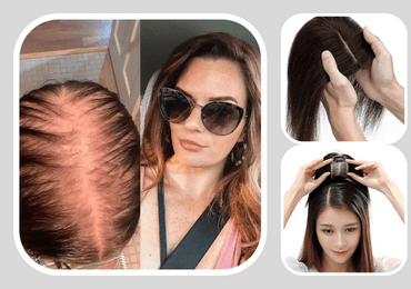 hair toppers for women, human hair toppers for women, Hair toppers Fixing near me, women hair toppers price